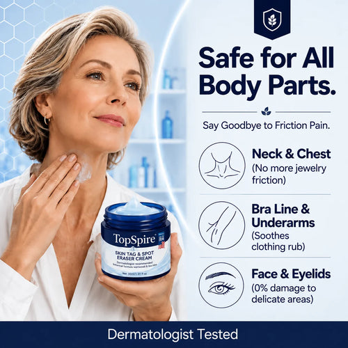 𝑻𝒐𝒑𝑺𝒑𝒊𝒓𝒆® 7-𝐃𝐚𝐲 𝐒𝐤𝐢𝐧 𝐓𝐚𝐠 & 𝐒𝐩𝐨𝐭 𝐄𝐫𝐚𝐬𝐞𝐫 𝐂𝐫𝐞𝐚𝐦 (Zero Pain, Zero 𝐒𝐜𝐚𝐫𝐬 Formula) 🦅