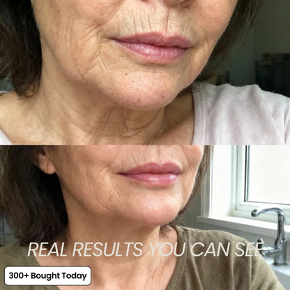 🎖️𝐎𝐟𝐟𝐢𝐜𝐢𝐚𝐥 𝐁𝐫𝐚𝐧𝐝 𝐒𝐭𝐨𝐫𝐞 🔥 LAST DAY 60% OFF VELNORS Korean Pink CollagenVolume Multi Balm